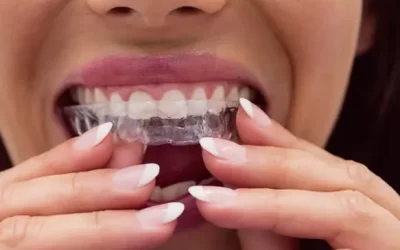 Invisalign Buffalo: Clear Aligner Therapy for Discreet Orthodontic Correction